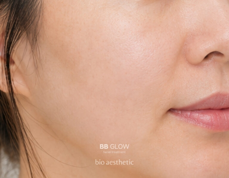 Dull-looking skin after