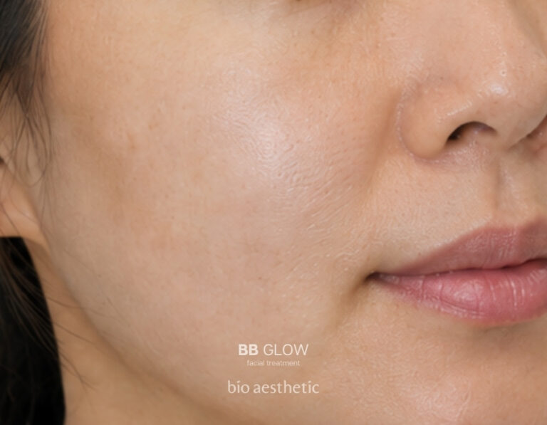 Dull-looking skin before