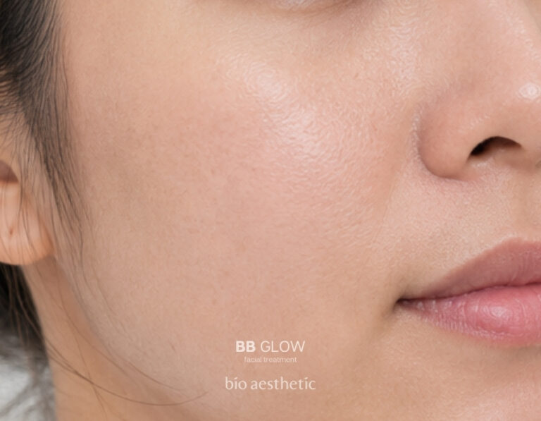 Uneven skin tone after