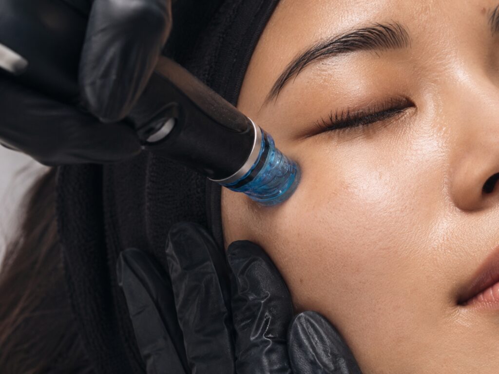 HydraFacial skin concern guide at Bio Aesthetic Medispa Singapore