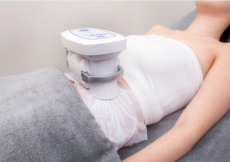 Freezing your fat