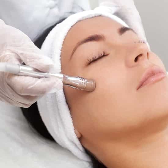 FRACTIONAL RF ACNE SCARS
