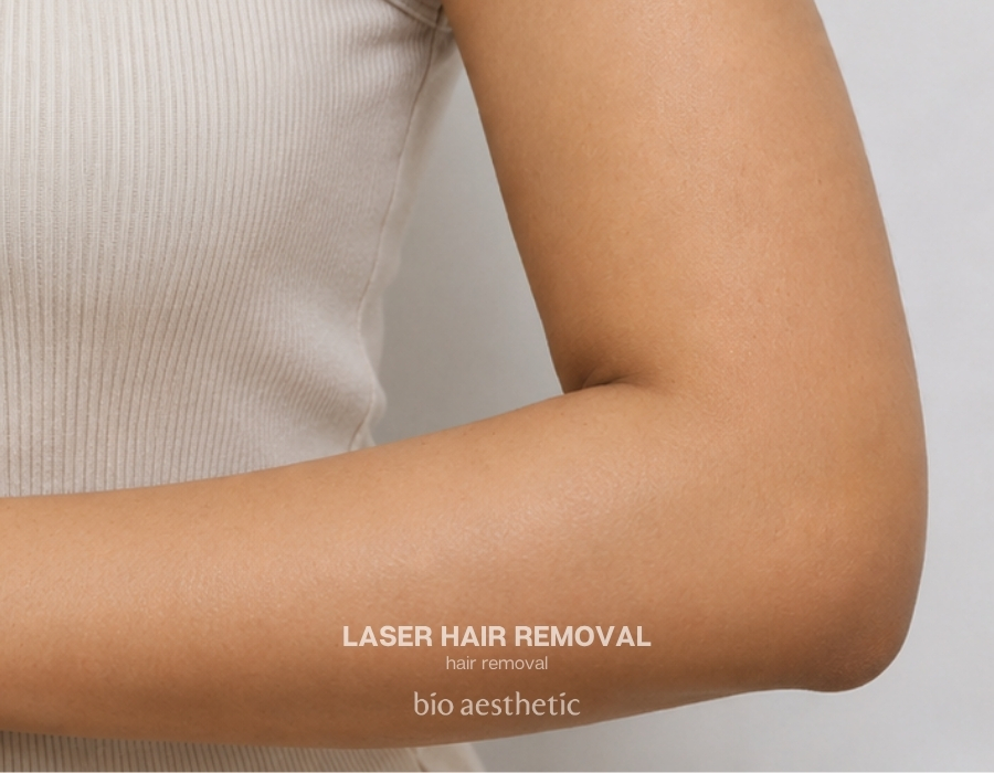 arm laser hair removal before and after 1