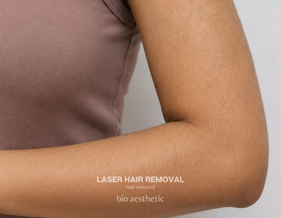 arm laser hair removal before and after