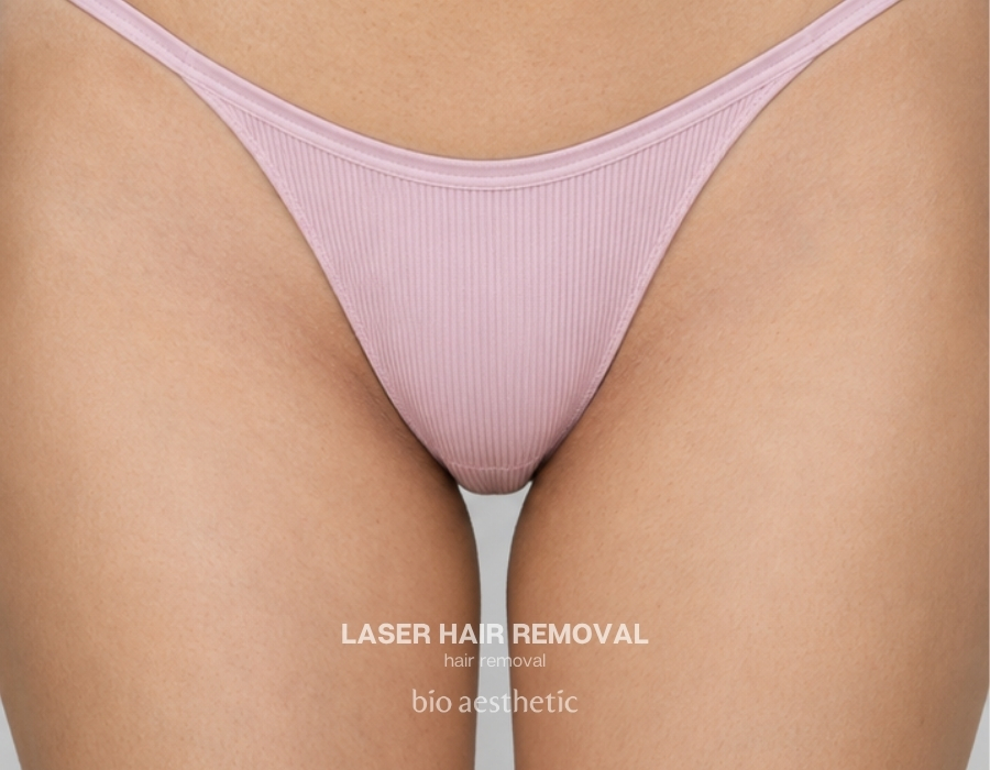 brazilian laser hair removal before and after 1