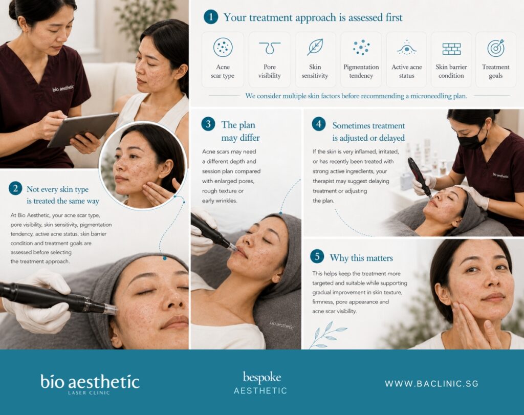 How Microneedling is selected for acne scars pores and wrinkles at Bio Aesthetic Medispa Singapore