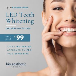 teeth whitening promotion trial