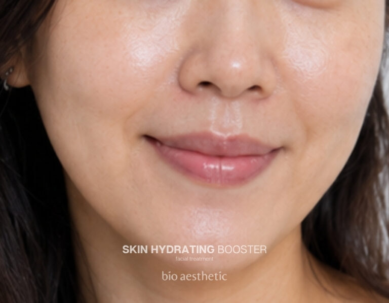 Dry skin after