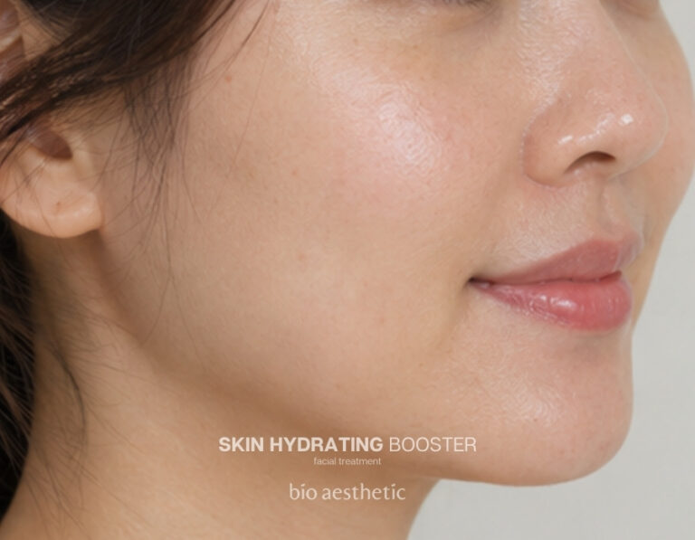 Dull-looking skin after