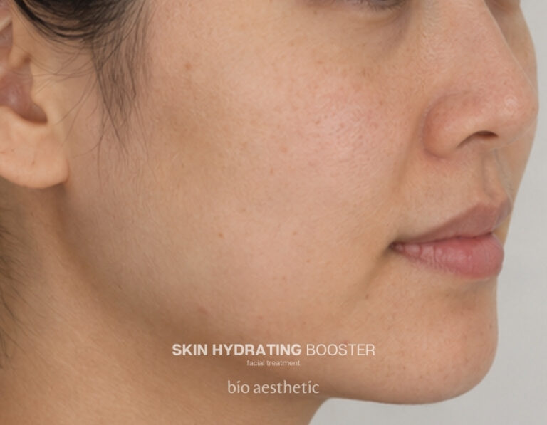 Dull-looking skin before