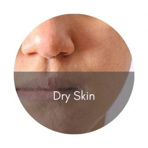 skinbooster dry skin