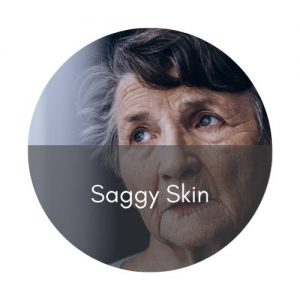 skinbooster saggy skin