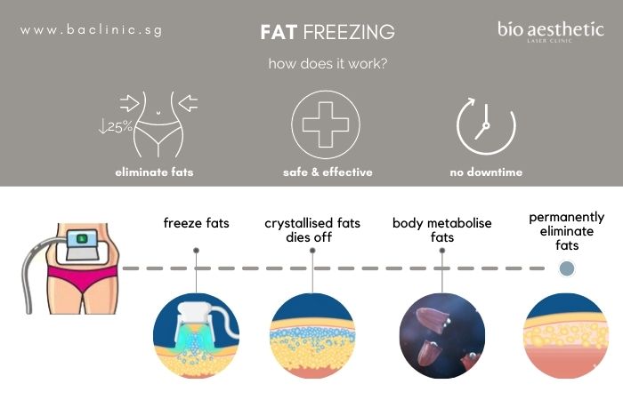 how does fat freezing work ?