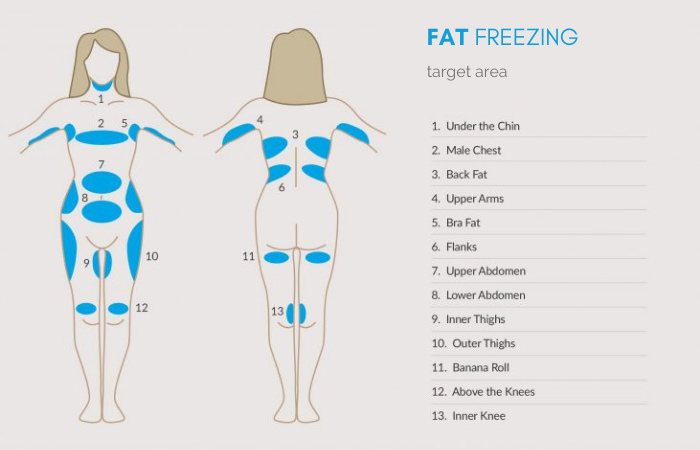 fat freezing before and after target area - where can fat freeze be targeted?