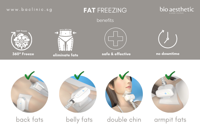 benefits of fat freezing before and after
