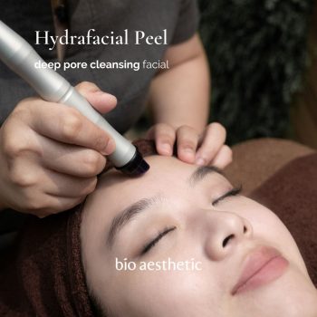 hydrafacial peel - facial treatment singapore