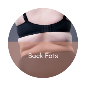 back fats slimming