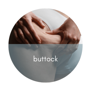 buttock cellulite