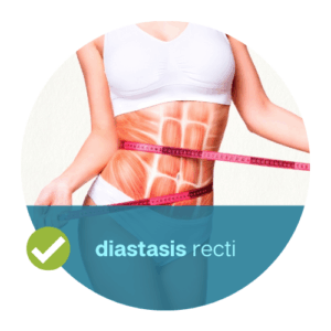 diastasis recti abdominal gap