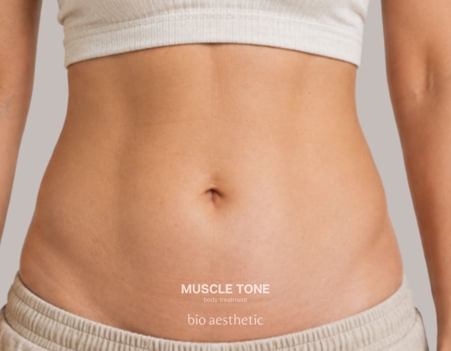 diastasis recti before and after muscle tone 2