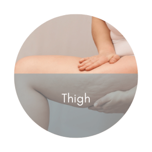 thigh cellulite