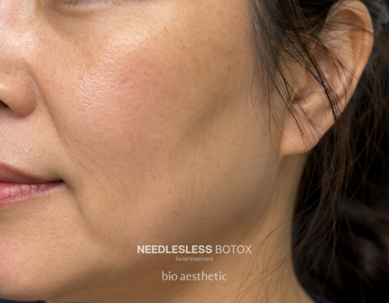 Sagging-looking skin after