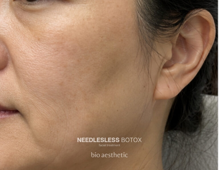 Sagging-looking skin before