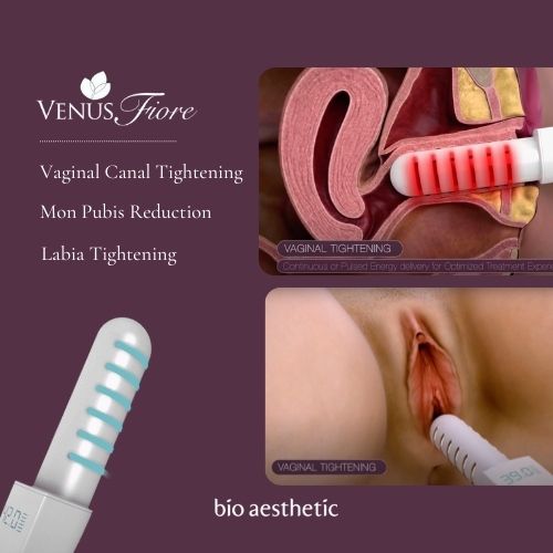 Postpartum intimate wellness support with Venus Fiore Singapore