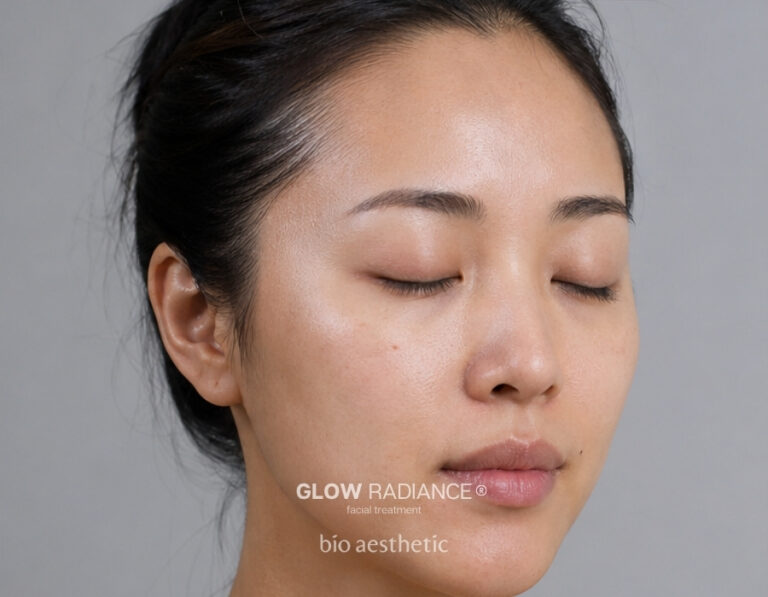 Dull Skin before