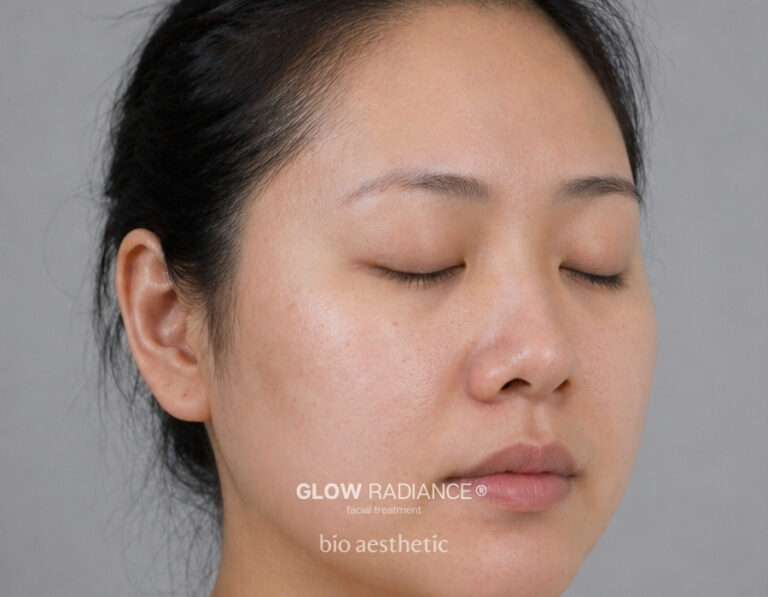Uneven Skin Tone before