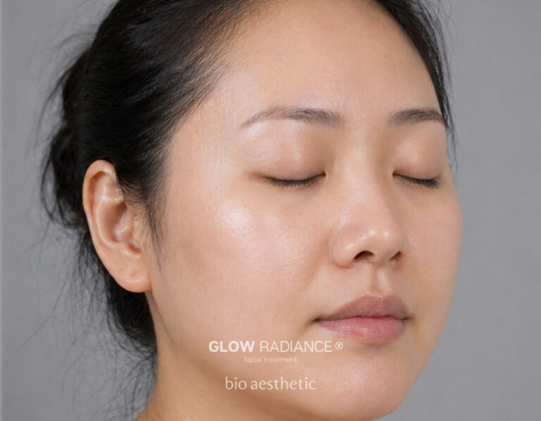 Uneven Skin Tone after