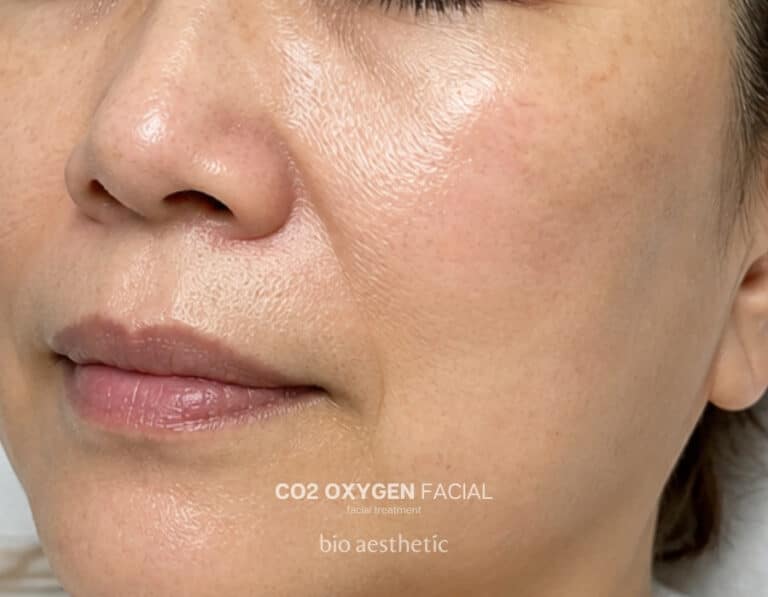 Dull skin after