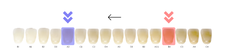 teeth whitening 8 shades whiter