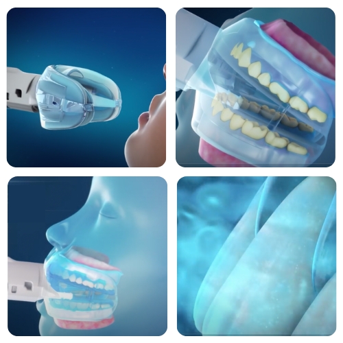 how does teeth whitening work?