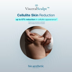 cellulite reduction