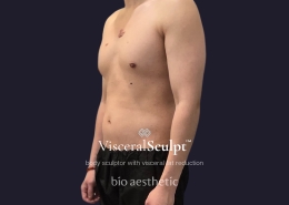 how to lose visceral fat before after 5