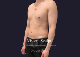 how to lose visceral fat before after 6