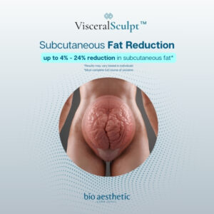 subcutaneous fat reduction