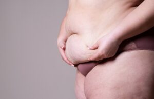 skin laxity and texture change skin laxity and texture change